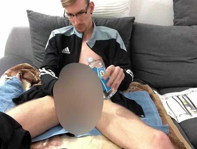 Video 141 - Dilatoren fun Cam 1 Teil 1-3