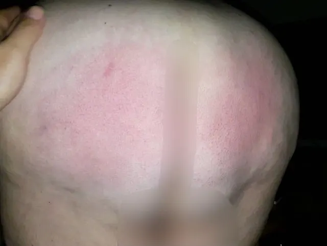 Mit der flachen Hand auf den Arsch