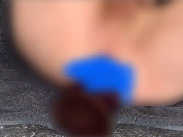 8,5cm reingeknallt