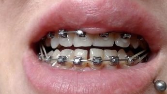 Hosenträger mit elastischer Nahaufnahme