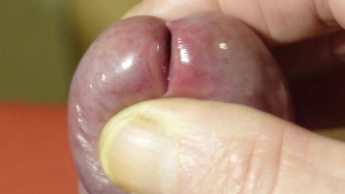 Dicke Kirsche für deinen Nuttenarsch