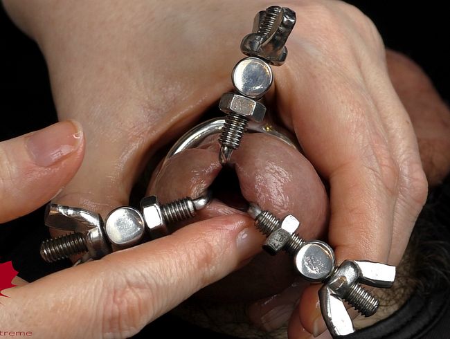 Dilatation der Loch expandierten Eichel und Spermablockade durch urethrales Einführen des Fingers II