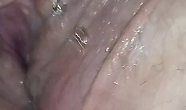 Es rinnt mir heiß dem Schenkel entlang…