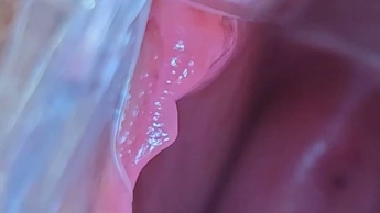 Eine gutbeleuchtete Fotze von Innen – Speculum und Tachenlampe